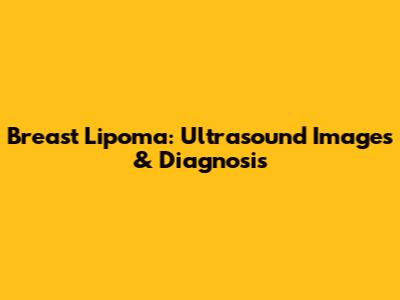 Breast Lipoma: Ultrasound Images & Diagnosis