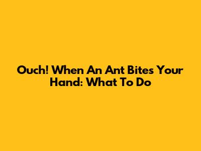 Ouch! When An Ant Bites Your Hand: What To Do