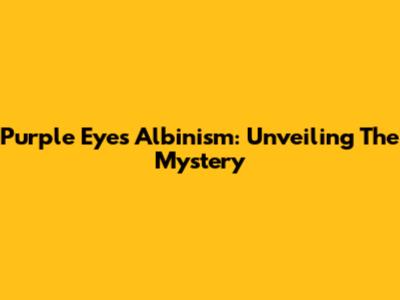 Purple Eyes Albinism: Unveiling The Mystery